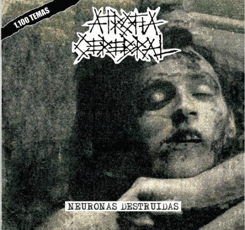 Atrofia Cerebral : Neuronas Destruidas